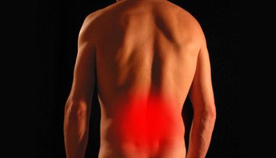 Schmerzlinderung im Rückenbereich